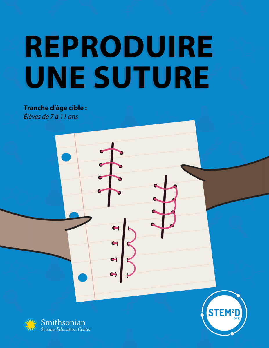 Shrinking sutures cover in French